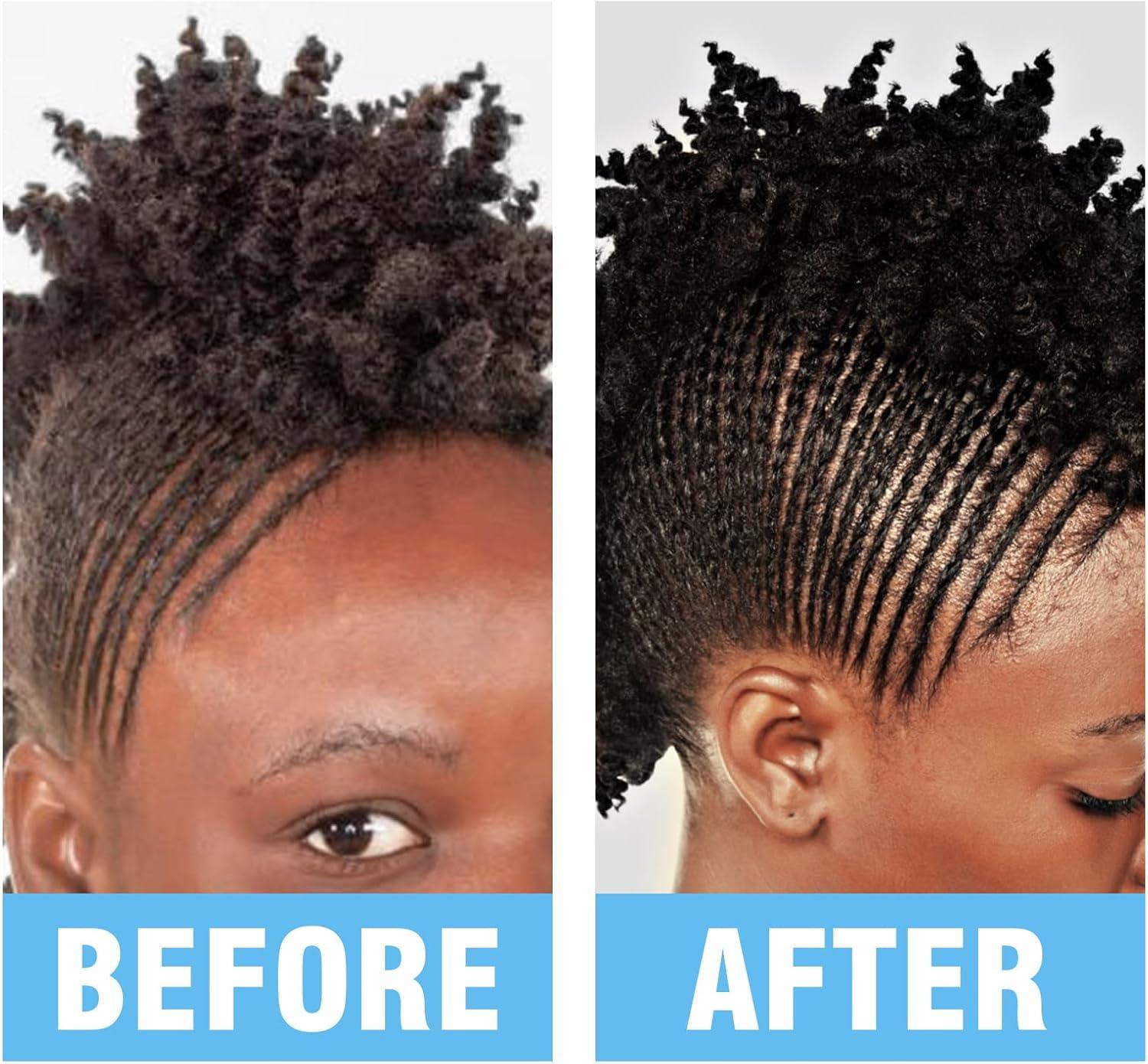 image10 FL OZ RinseFree Shampoo for Braid No Water Shampoo for Locs Braids Twists Weaves Dreadlock Dry Spray for BuildUp Odor Itch ampamp Flakes No Residue Chemical Free