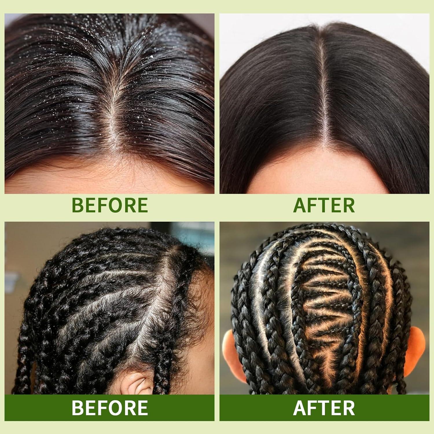 imageLoc Shampoo Bar ampamp Conditioner Braid Shampoo Bar Works for Dreadlocks Microlocs Sisterlocks Braids Remove Product  Rose Water for Hair Loc Spray Moisturizing Refreshing ampamp Wooden Holder